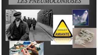 PNEUMOLOGIE Les pneumoconioses 2016 [upl. by Bick]