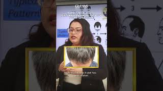 AESTHETIC CLINIC MALAYSIA  Rambut Gugur Selepas Prosedur [upl. by Annoyed]