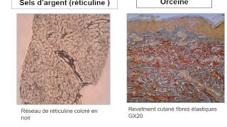 ANATOMIE PATHOLOGIQUE Travaux Pratiques [upl. by Flavia516]