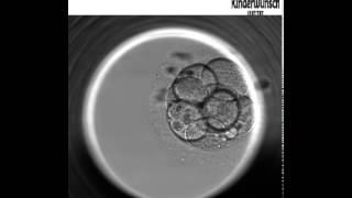 Die Embryo Entwicklung bis zur Blastozyste  Embryoskop [upl. by Godber]