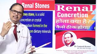 Renal concretion kidney me balu ka dana DrProfSantosh Kumar PGI [upl. by Pacificas]