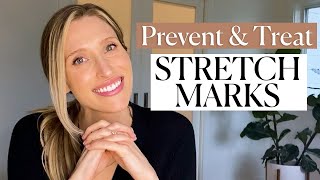 Can You Prevent Stretch Marks A Dermatologist Explains Causes amp Treatments  Dr Sam Ellis [upl. by Letha611]