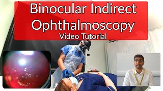 Binocular Indirect Ophthalmoscopy Tutorial [upl. by Giavani404]