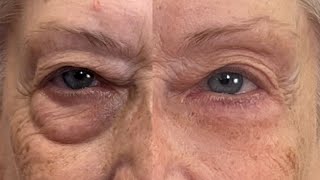 Get Rid of Eye Bags Instantly Eliminate Puffiness and Darkness 🚨 Fierce Aging with Nikol Johnson [upl. by Dnana]