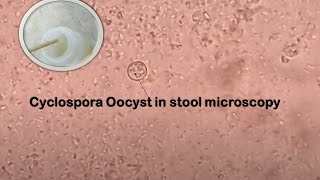 Cyclospora in Stool Microscopy [upl. by Odelia]