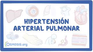 NORD  Hipertensión Arterial Pulmonar [upl. by Bartolome]