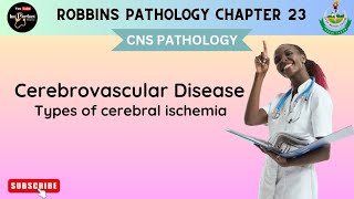 CEREBROVASCULAR DISEASES  Global Cerebral Ischemia  Focal Cerebral Ischemia  Robbins pathology [upl. by Ivatts]