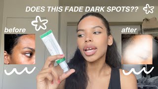 AXISY Dark Spot Correcting Glow Serum Review Does It Really Work [upl. by Adnawad]