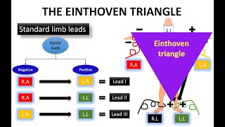 WHAT DO YOU KNOW ABOUT THE EINTHOVENS TRIANGLE ON ECG quotCHEST LEADSquot  NARCOSIS😴🤤 [upl. by Salvay]