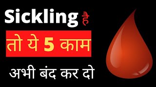 sickling है तो ये 5 काम अभी बंद कर दोSickle cell anemia [upl. by Sakram]