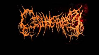 Cephalotripsy  Uterovaginal Insertion of Extirpated Anomalies FULL ALBUM [upl. by Cadal360]