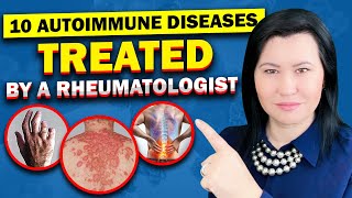 Top 10 Autoimmune Diseases A Rheumatologist Diagnose and Treat [upl. by Llenaej141]