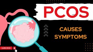 PolyCystic Ovary Syndrome PCOS  What if you have PCOS  PCOS early signs [upl. by Hirza356]