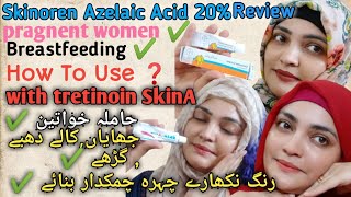 Skinoren Cream20Azelaic Acid Review How To Use Azelaic Acid With TretinoinSkinA Cream Retinoid [upl. by Kinson]