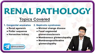 🌟 Exploring Renal Pathology Congenital Anomalies amp Nephrotic Syndromes 🌊 [upl. by Ytissac]