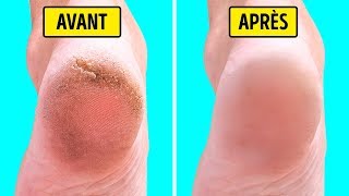 COMMENT AVOIR DES PIEDS DOUX ET LISSES EN 5 MIN  — Ma routine pieds LOVASKIN [upl. by Ciredor]