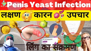 how to treat penile yeast infection  fungal penis infection  genital infection candidiasis [upl. by Bostow]