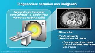 Cáncer de páncreas fisiopatología diagnóstico y estadificación [upl. by Seravart62]