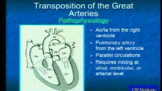 Congenital Heart Disease in Adults [upl. by Anema64]