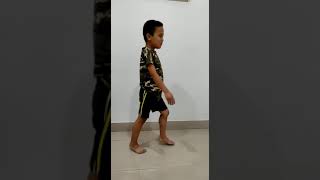 Duchenne Muscular dystrophy Lordotic posture waddling gait due to gluteus muscle weakness [upl. by Mehsah]