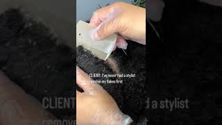 Flaky Scalp Removal On Natural Hair [upl. by Aitnauq107]