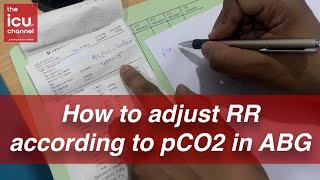 How to adjust Respiratory Rate RR according to pCO2 levels in ABG [upl. by Decker]