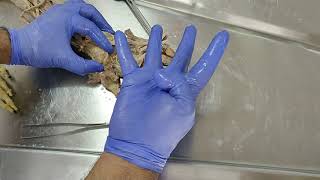 Dissection  Revision of Lumbricals of the hand [upl. by Siuraj]