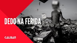 FILME  Dedo na ferida 2017 [upl. by Erin]