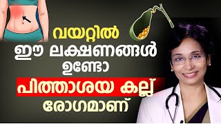 വയറ്റിൽ ഈ ലക്ഷണങ്ങൾ ഉണ്ടോ പിത്താശയ കല്ല് രോഗമാണ്  pithashayathil kallu  Arogyam [upl. by Zaragoza]