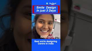 Best Smile Designing in India  Teeth Gap Treatment in India  smiledesigning smilemakeover [upl. by Nanci]