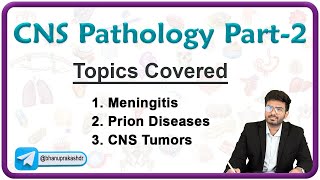 CNS Pathology Part  2  Meningitis Prion diseases and CNS Tumors [upl. by Thurston]