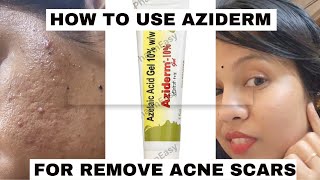 aziderm gel review honest reviewhow to use azelaic acid for acne amp acne marksacnetreatment viral [upl. by Thamos]