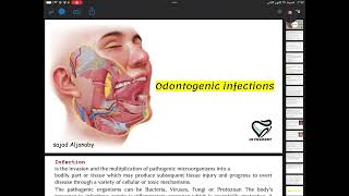 Odontogenic infections surgery 4th stageجراحة فم مرحلة رابعةطب اسنان [upl. by Cummings905]