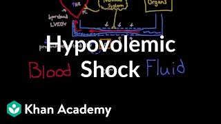 Hypovolemic shock  Circulatory System and Disease  NCLEXRN  Khan Academy [upl. by Anirehtac944]