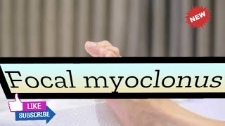 Focal myoclonus [upl. by Aziar]