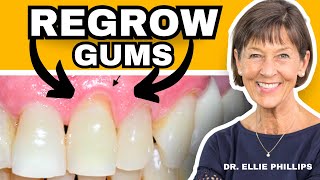 How To REGROW Receding Gums FIX Gum Recession At Home [upl. by Eerac421]