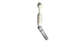 Ankylos® SmartFix – Prosthetic solution on tilted implants  Dentsply Sirona [upl. by Anaig]