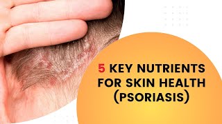 5 Key Nutrients for Skin Health Psoriasis [upl. by Andee]