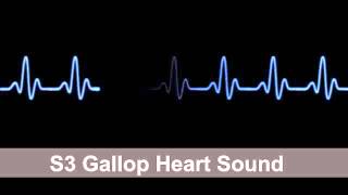 S3 Gallop Heart Sound Collection For Auscultation Skills [upl. by Juliet228]