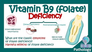 Folate deficiency  What are the symptoms of low folic acid  Harmful effects of Folate deficiency [upl. by Esiuqcaj544]