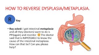 Metaplasia dysplasia How to reverse dysplasia metaplasia Natural treatment [upl. by Eiduj]