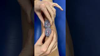 Cupping therapy to mobilize suturesphysiotherapyclinic physiotwist physiotherapyworld [upl. by Verla]