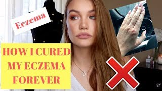 HOW I CURED MY ECZEMA FOREVER [upl. by Hokanson]