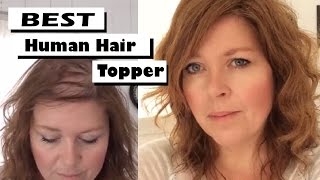 Best human hair toppers amp hairpieces for fine thinning hair amp ALOPECIA  One womans touching story [upl. by Tennaj]