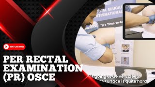 Per Rectal Examination PR  OSCE Guide [upl. by Nnaerb]