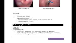 L2223  Hoarseness of voice  ENT 41 [upl. by Sandor648]