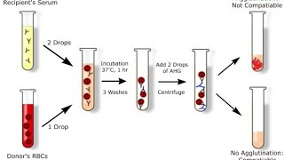 cross matching blood procedure [upl. by Lenad584]