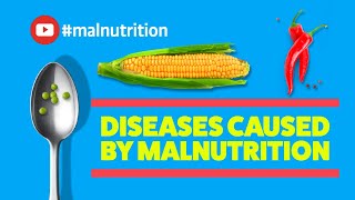 Diseases Caused by Malnutrition  SCURVY RICKETS BERIBERI PELLAGRA [upl. by Tigram160]