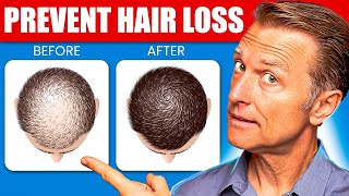 12 Proven Remedies to Prevent Hair Loss and Regrowth Regrow hair [upl. by Ness]