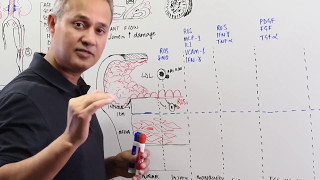 Atherosclerosis Pathology and Cellular Events [upl. by Toney]